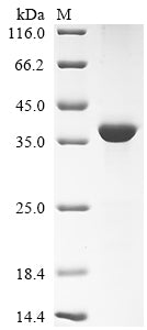SDS-PAGE