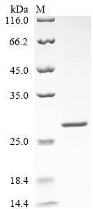 SDS-PAGE