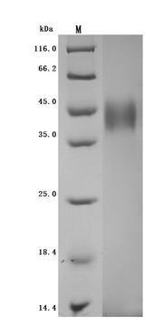 SDS-PAGE