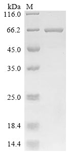 SDS-PAGE
