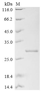SDS-PAGE