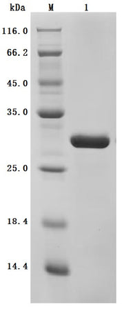 SDS-PAGE