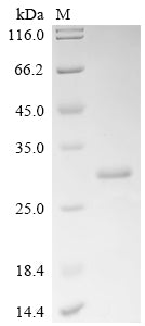 SDS-PAGE