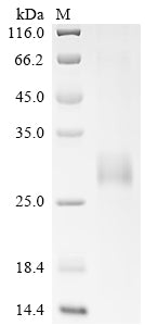 SDS-PAGE