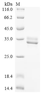 SDS-PAGE