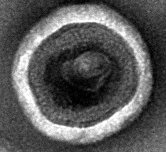 LC-MS Image URL/Western Blot