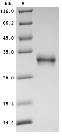 SDS-PAGE