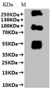 SDS-PAGE