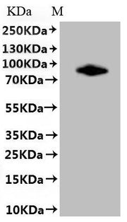 SDS-PAGE