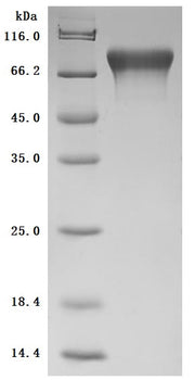 SDS-PAGE
