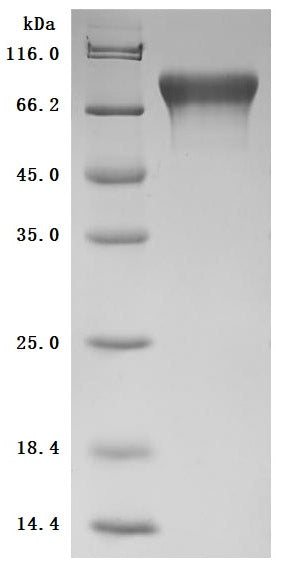 SDS-PAGE