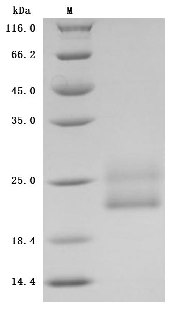 SDS-PAGE