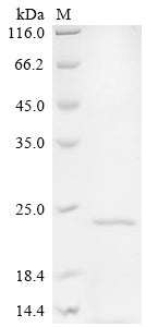 SDS-PAGE