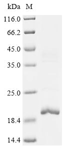 SDS-PAGE