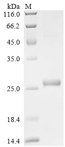 SDS-PAGE