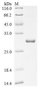 SDS-PAGE