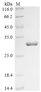 SDS-PAGE