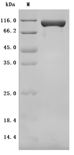 SDS-PAGE