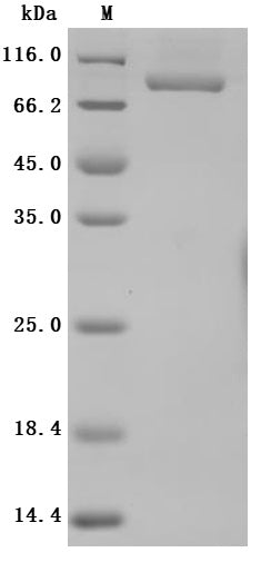 SDS-PAGE