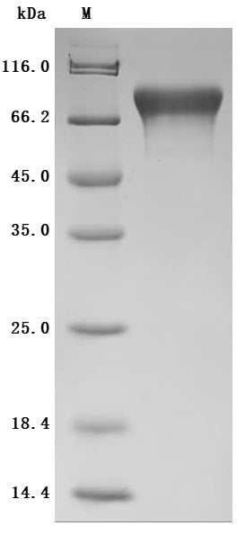 SDS-PAGE
