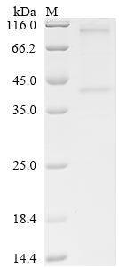 SDS-PAGE