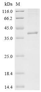 SDS-PAGE