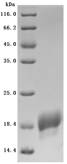 SDS-PAGE