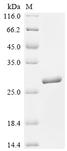 SDS-PAGE
