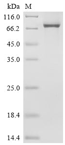 SDS-PAGE