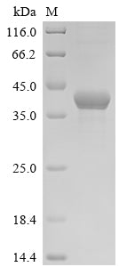 SDS-PAGE