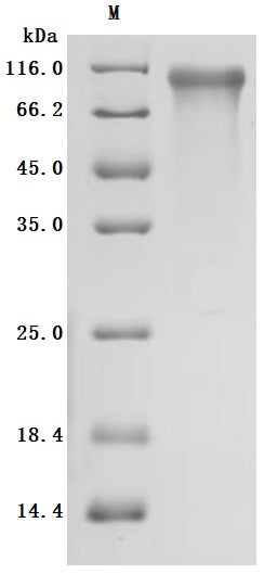 SDS-PAGE