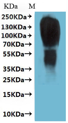 Western Blot