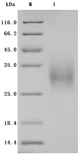 SDS-PAGE
