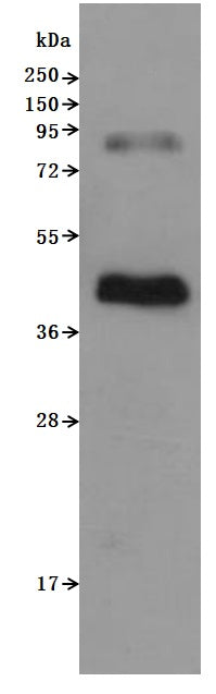 Western Blot