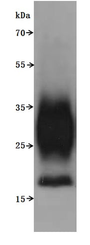Western Blot