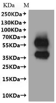 Western Blot