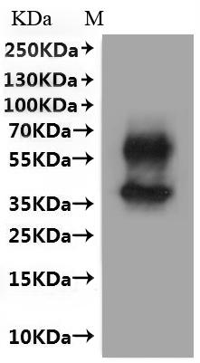 Western Blot