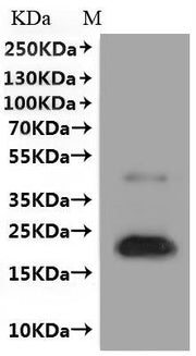 Western Blot