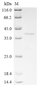 SDS-PAGE