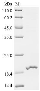 SDS-PAGE