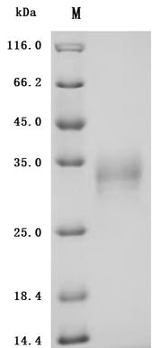 SDS-PAGE