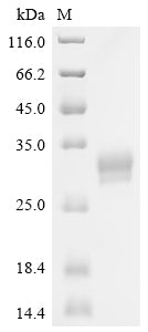 SDS-PAGE