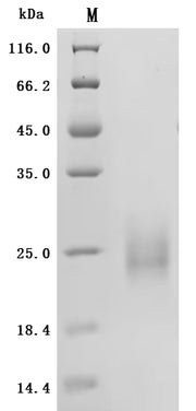 SDS-PAGE