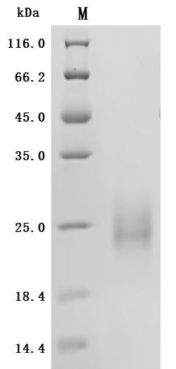 SDS-PAGE