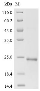 SDS-PAGE
