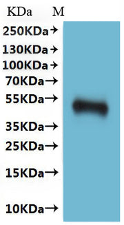 Western Blot