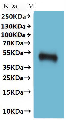 Western Blot