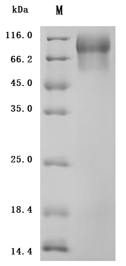 SDS-PAGE