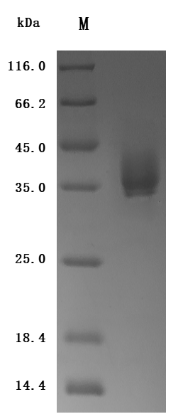 SDS-PAGE