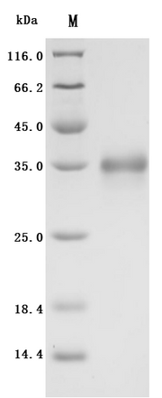 SDS-PAGE
